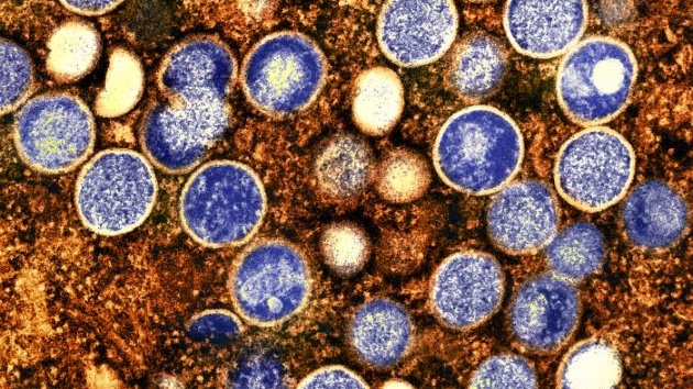 Mpox virus particles. Via CDC/ National Institute of Allergy and Infectious Diseases (NIAID)