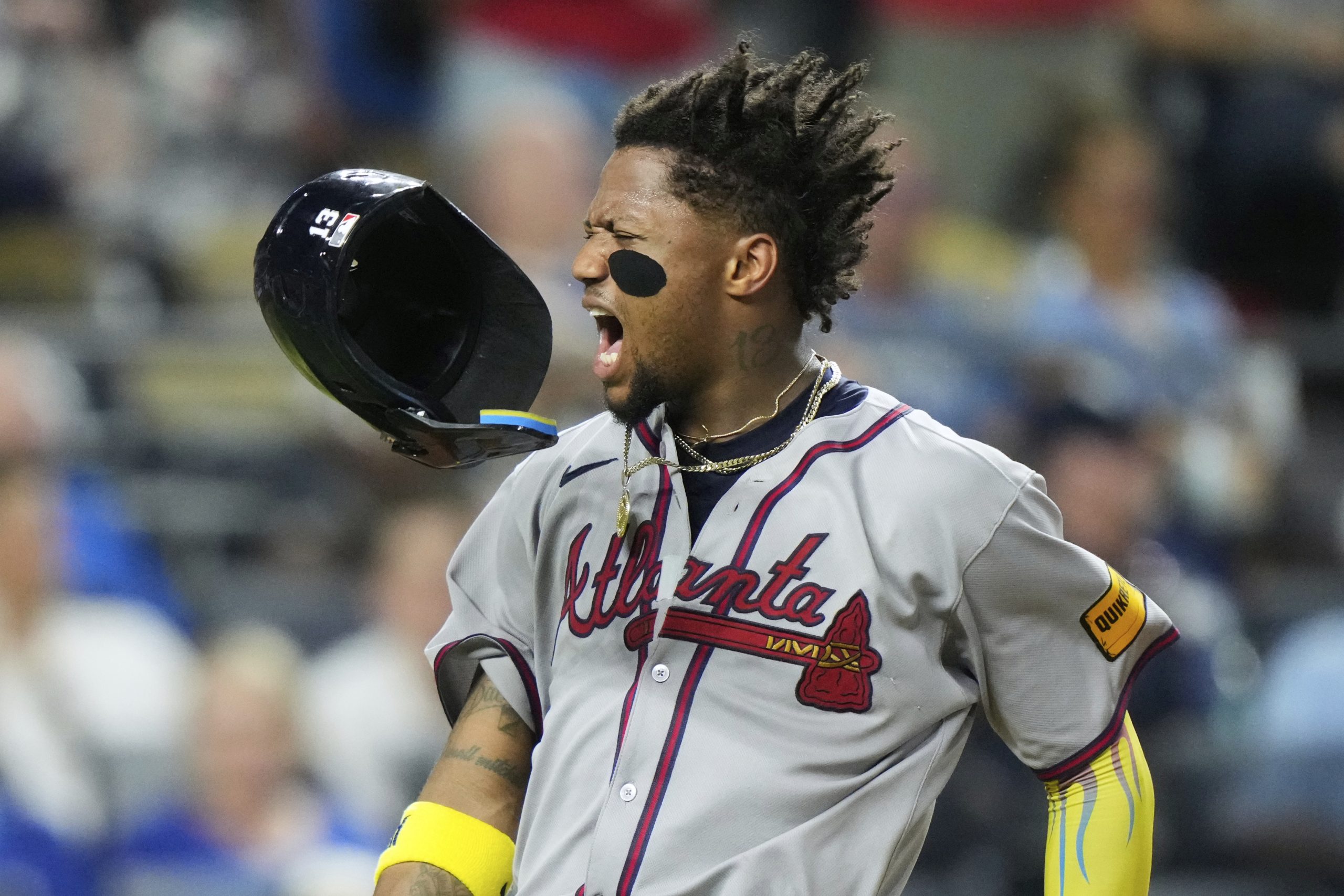 Braves All-Star OF Ronald Acuña Jr. leaves with Achilles tendon tightness and will go to IL