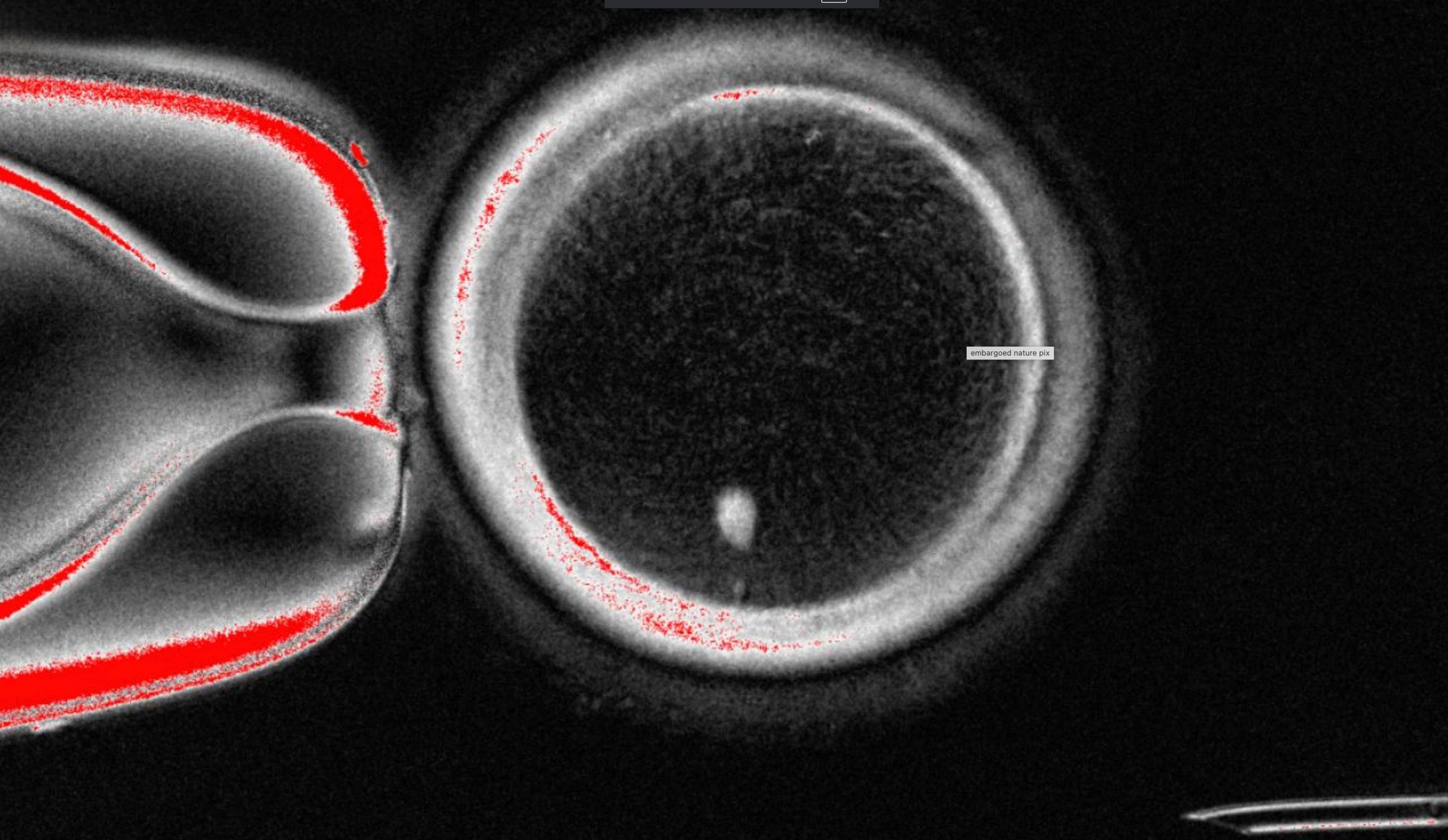 Researchers turn human skin cells into eggs — but not yet usable ones
