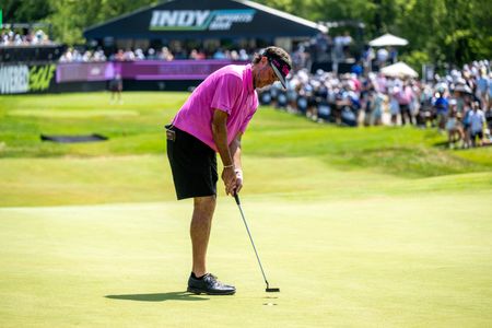 Bubba Watson’s season ending prematurely due to finger surgery