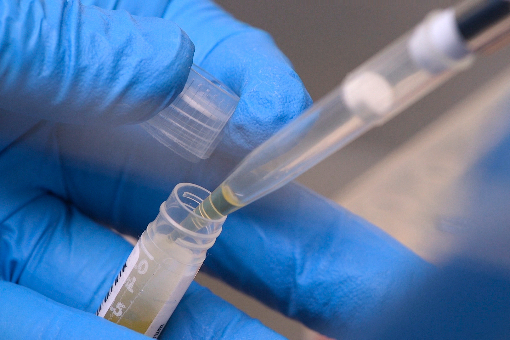 NIH funding cuts have affected over 74,000 people enrolled in experiments, a new report says