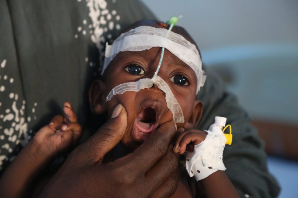 A visit to Somalia’s crumbling hospitals shows the toll of aid cuts and war
